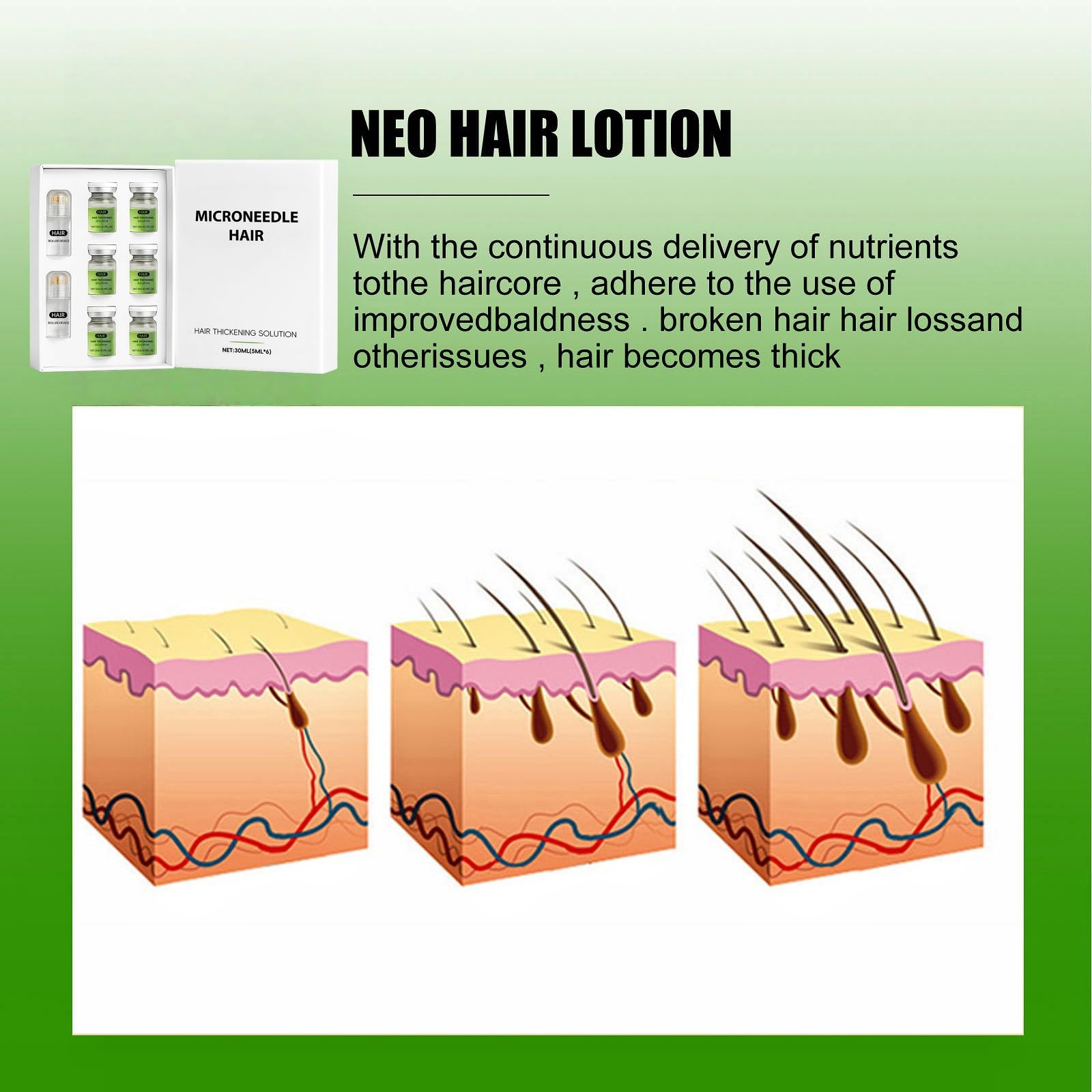 Hair Regrowth System, New Hair Growth Serum & Regrowth Treatment for Women & Men, Micro-Needling Infusion Scalp Serum - Image 4
