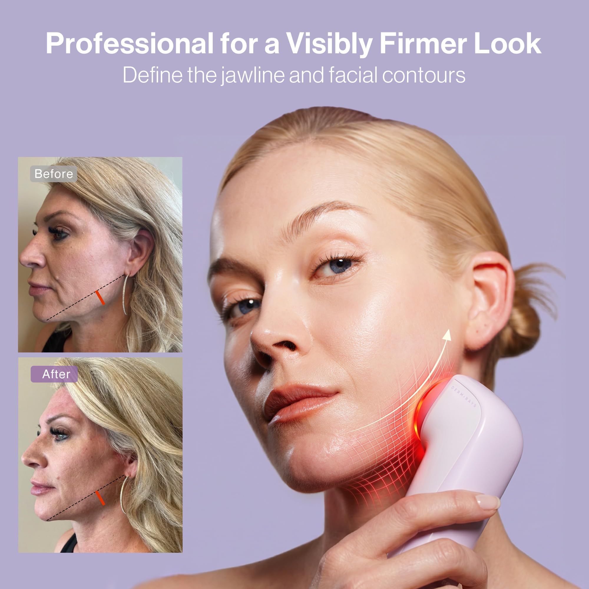 DermRays Neue Kosmetik M1,4 Limo Little Face, Leds Red Light, Leds Geräte, Die für Anti-aging Sorgen, Gesicht Strafft, Falten, Brust Und Ausstrahlung