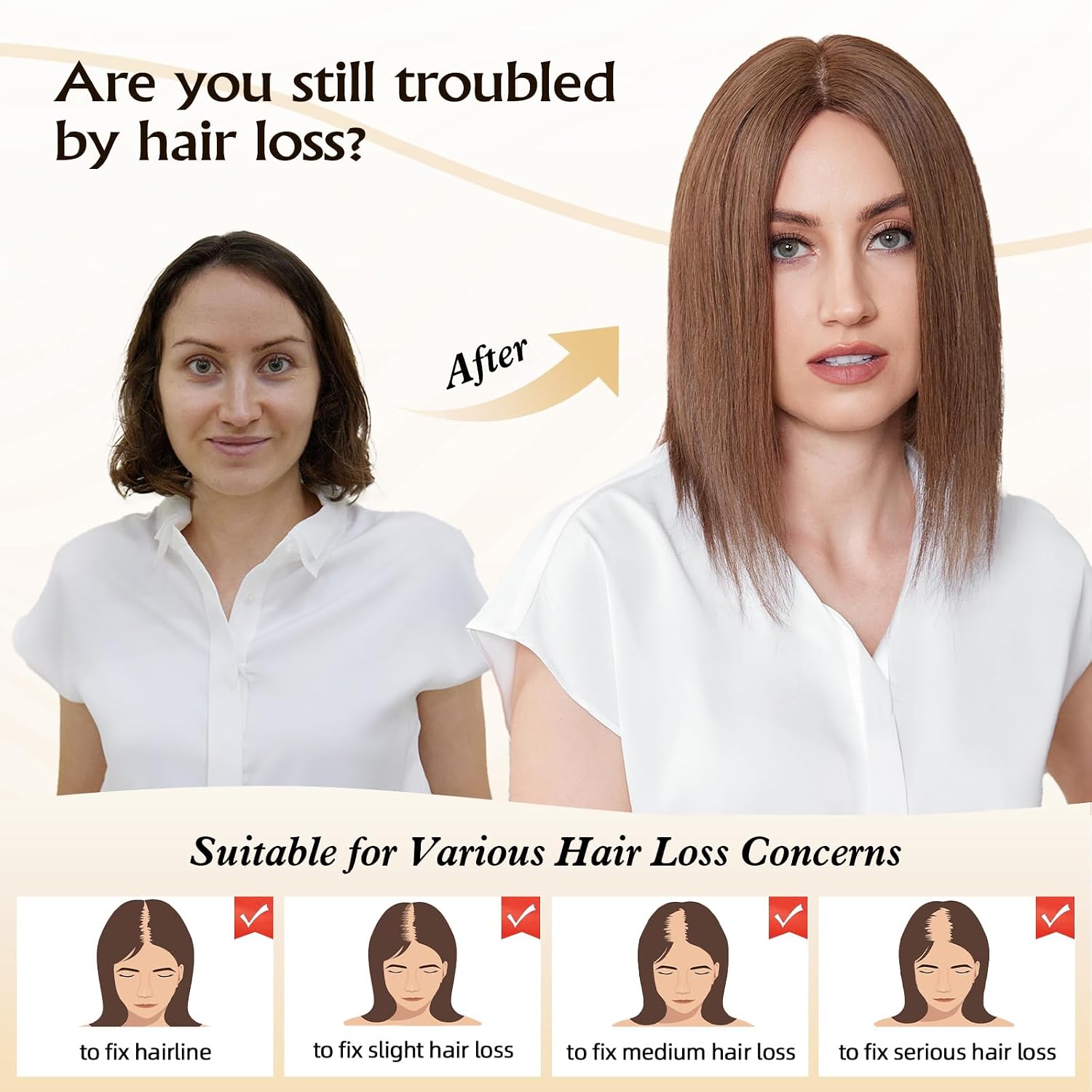 5.5"×5" Human Hair Toppers 12 inches for Women,100% Remy Human Hair with 4 Non-slip Clips and Large-area Simulation Scalp Base,Top Hairpieces for Women with Thin Hair(Brown)