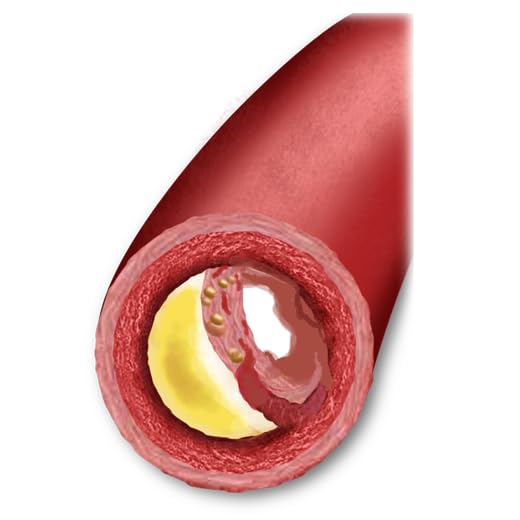 Cholesterol Guide