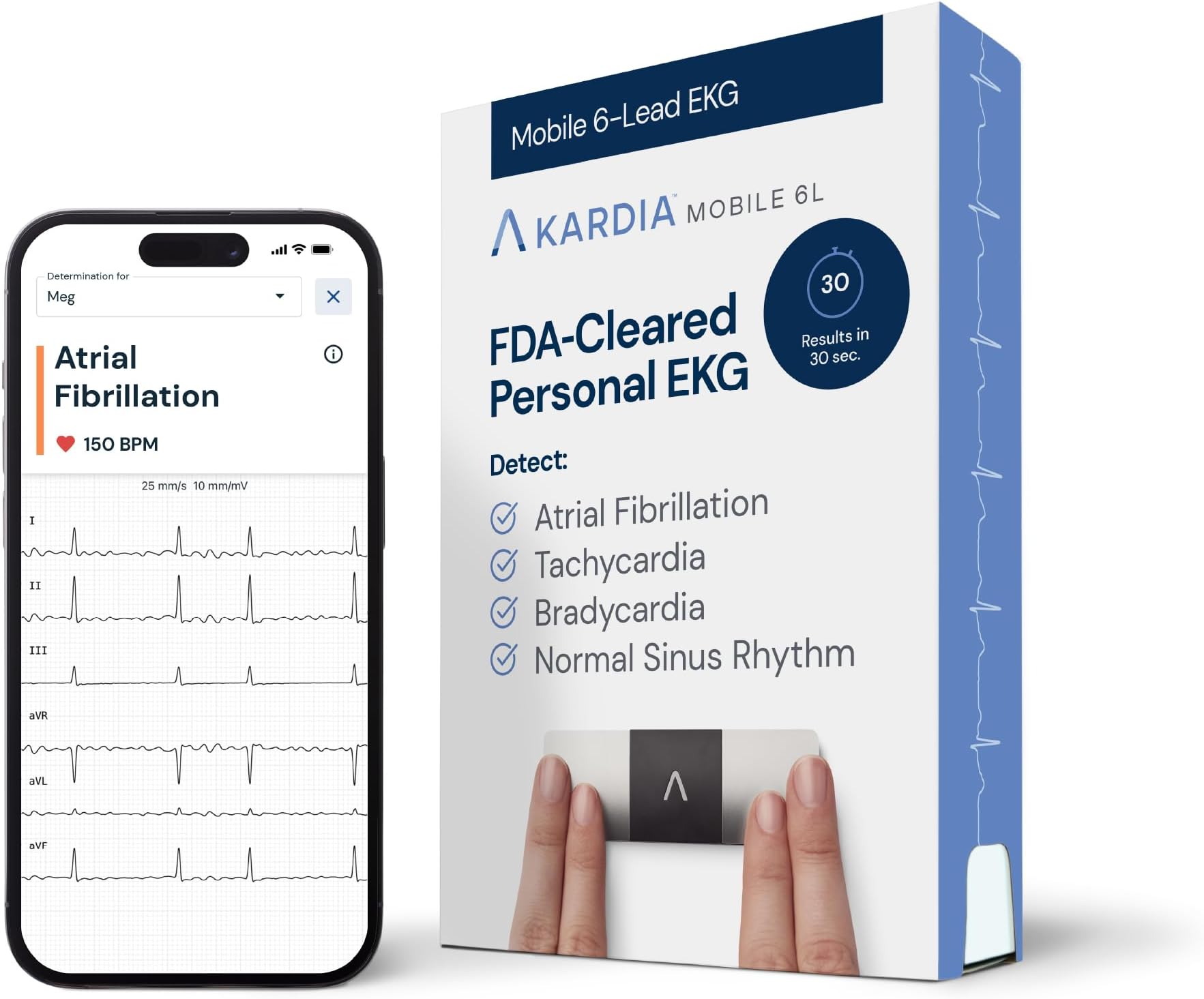 KardiaMobile 6-Lead Personal EKG Monitor – Six Views of The Heart – Detects AFib and Irregular Arrhythmias – Instant Results in 30 Seconds – Works with Most Smartphones - FSA/HSA Eligible
