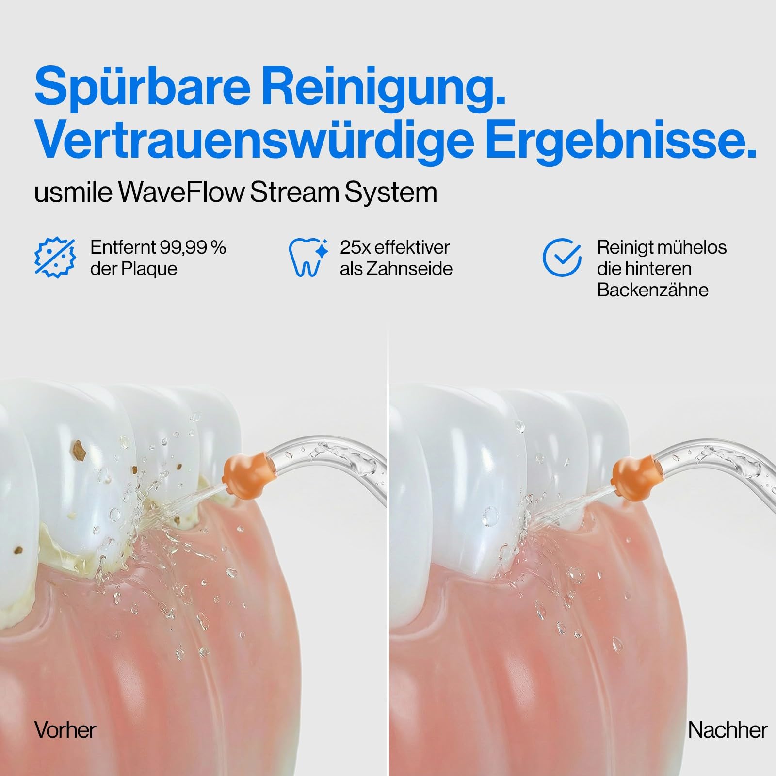 usmile C30 Tragbare Munddusche Kabellos, 300 ml Wassertank, 5 Druckstufen, S-Düsen für Zahnspangen & Invisalign, USB-C wiederaufladbar, IPX7 wasserdicht, Schwarz