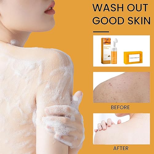 Turmeric Wash and Care Four Piece Set, Tuemeric Facial Cleanser & Turmeric Soap Combo, Turmeric Cleansing Mousse, Face Wash and Soap Bundle for Face & Body Deep Cleansing (1pc Turmeric Wash+3pc Soaps)
