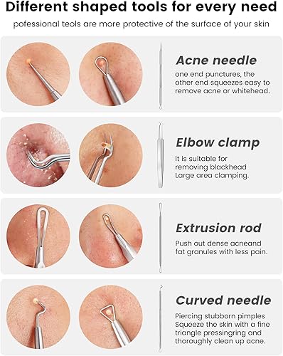 Miniatura 4 de Kit de herramientas para reventar espinillas, kit de 6 piezas de extracción de puntos negros, kit extractor de comedones con caja para eliminación