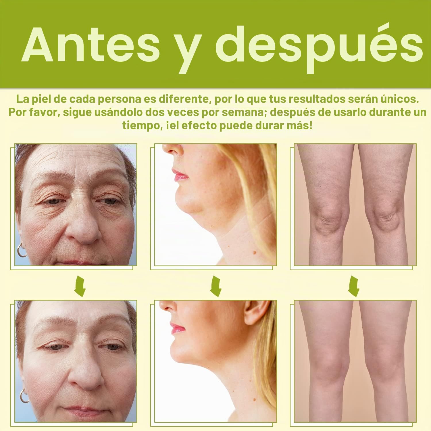 TUMAKOU Radiofrecuencia Facial Máquina, Dispositivo de la belleza de la cara del RF, Antiedad, Rejuvenecimiento de la piel Anti-arrugas