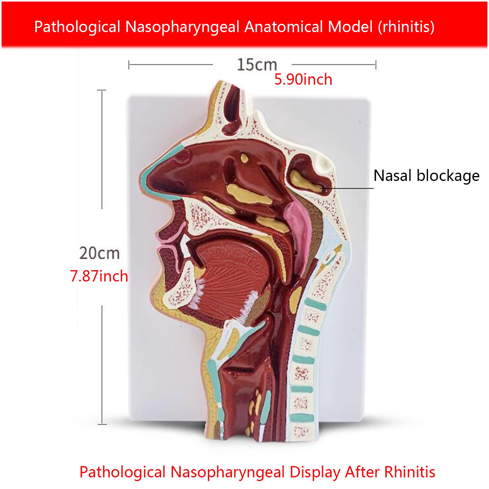 Modello di Anatomia nasale Umana - Modello di insegnamento del rinofaringe e della Gola - Modello della laringe faringea per l'educazione scientifica,Rhinitis