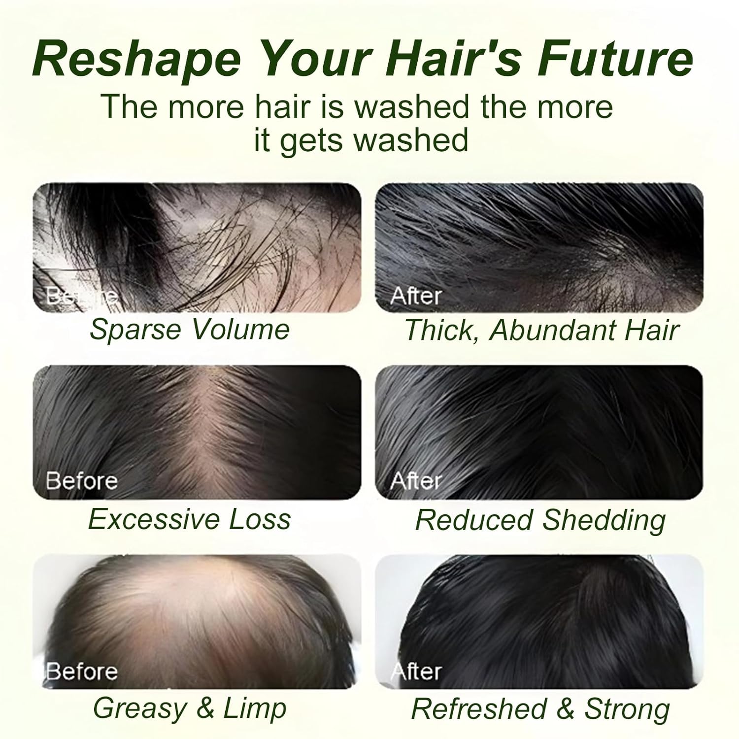 Tgideas Batana Oil & Rosemary Shampoo for Hair Growth, Formula for Thinning Hair & Reduce Hair Loss, Nourish Scalp & Add Volume, for Men & Women (Pack of 2) - Image 7