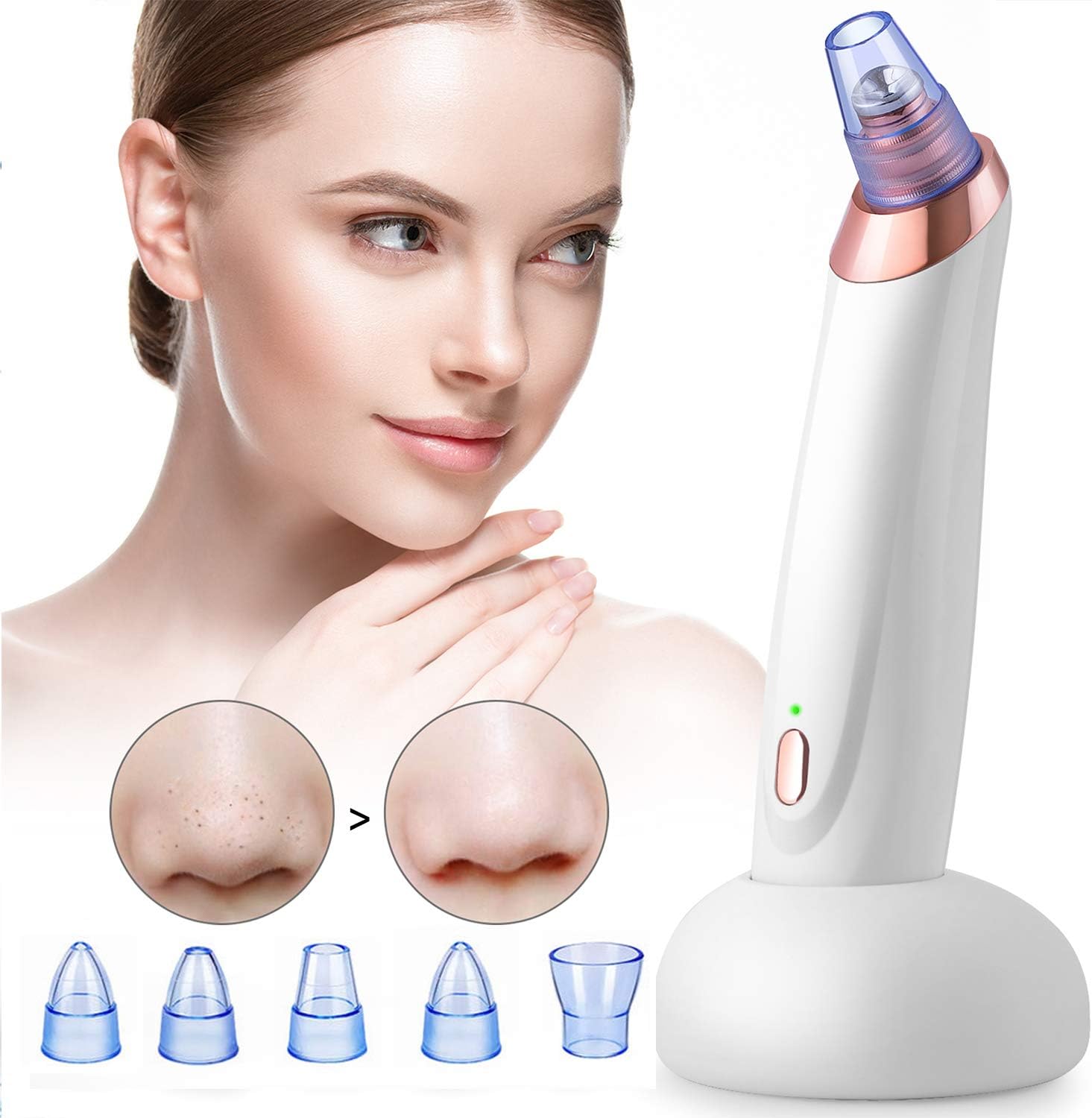 Blackhead Remover Pore Vacuum MARYSUN Blackhead Vacuum Comedone Extractor Pimple Rechargeable Remover with 5 Suction Head