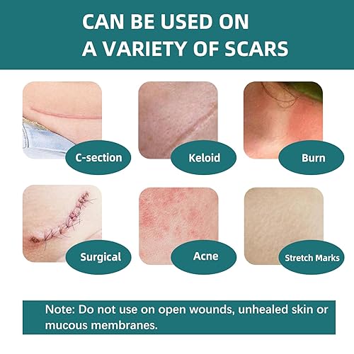 Miniatura 4 de Cinta de silicona para cicatrices quirúrgicas láminas de gel de cicatrices de grado médico para recuperación y tratamiento de abdominoplastia de