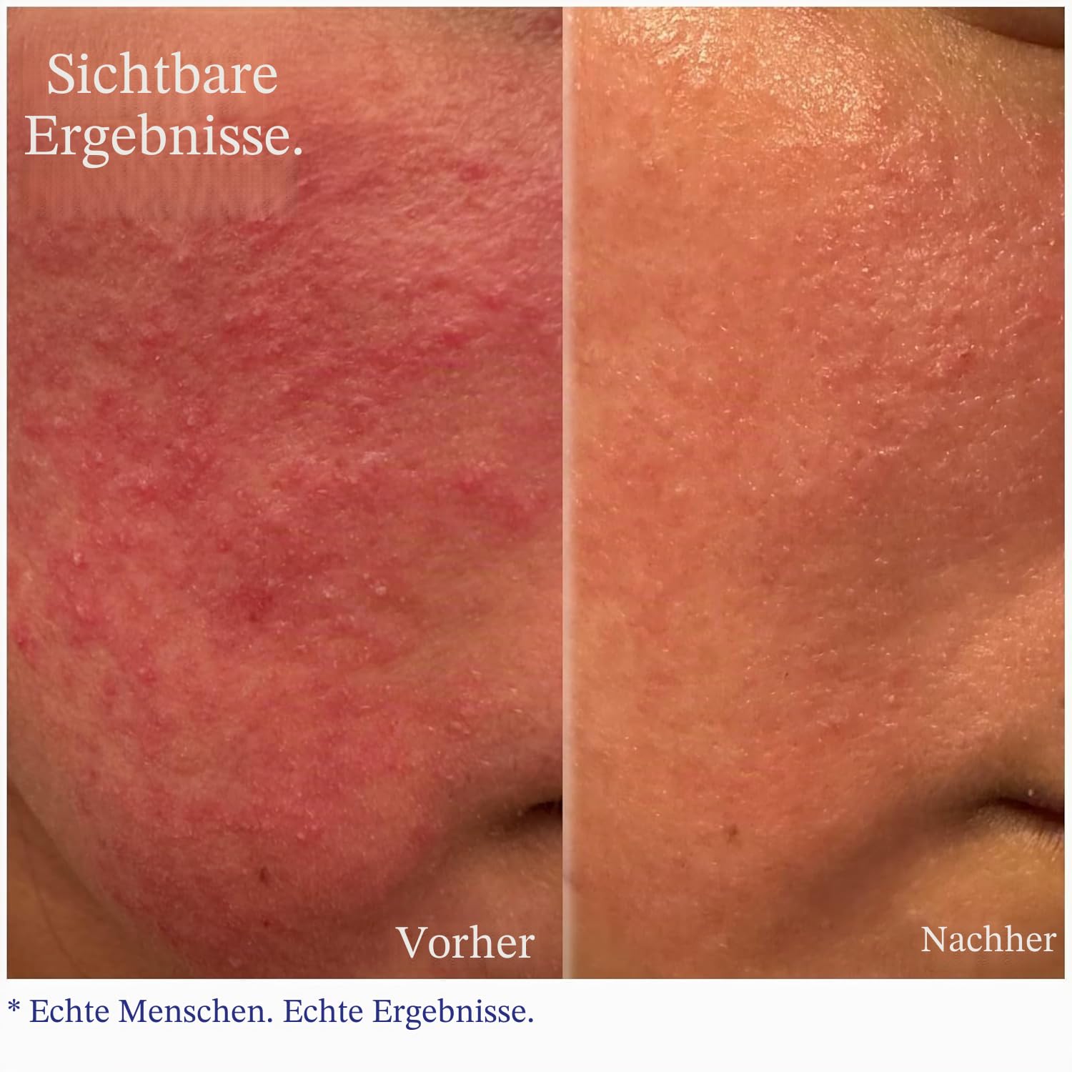 Hey Honey Relax Gesichtscreme mit Propolis & Honig für empfindliche Haut, Rosazea & Rötungen | Anti-Aging Feuchtigkeitscreme für reife Haut | Dermatologisch getestet, ölfrei | 60g