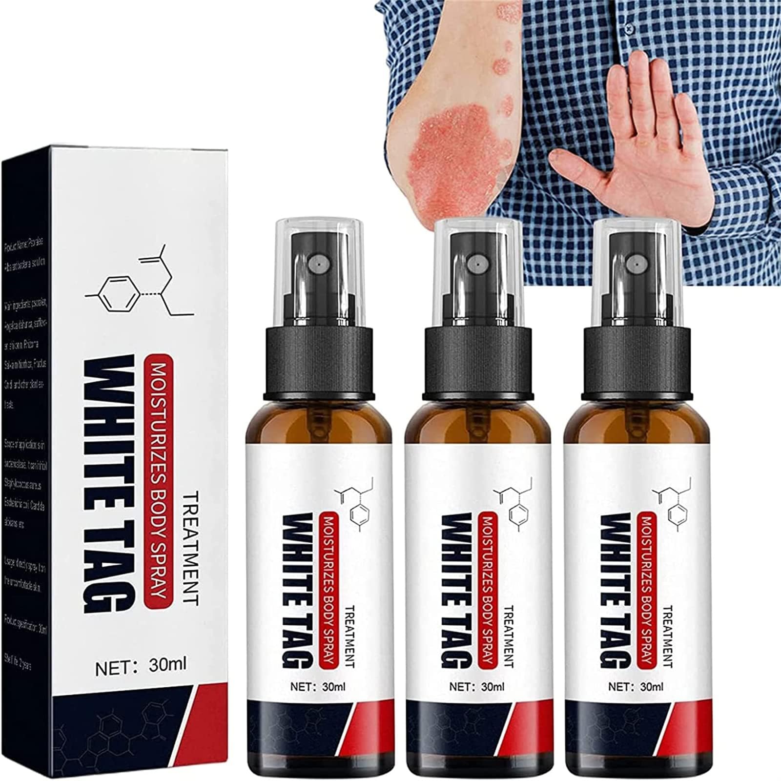Miurixo Psoriasis Treatment Spray,Psoriasis Cream for Body,Vitiligo Treatment Spray,Skin Repair Spray, Reduces White Spots on Skin and Improve Skin Pigmentation (3pcs)
