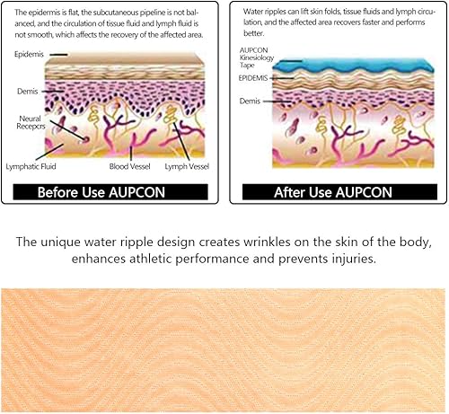 Miniatura 6 de AUPCON Cinta de kinesiología elástica terapéutica atlética, hipoalergénica, transpirable, de algodón, cinta muscular, terapia, apoyo para la