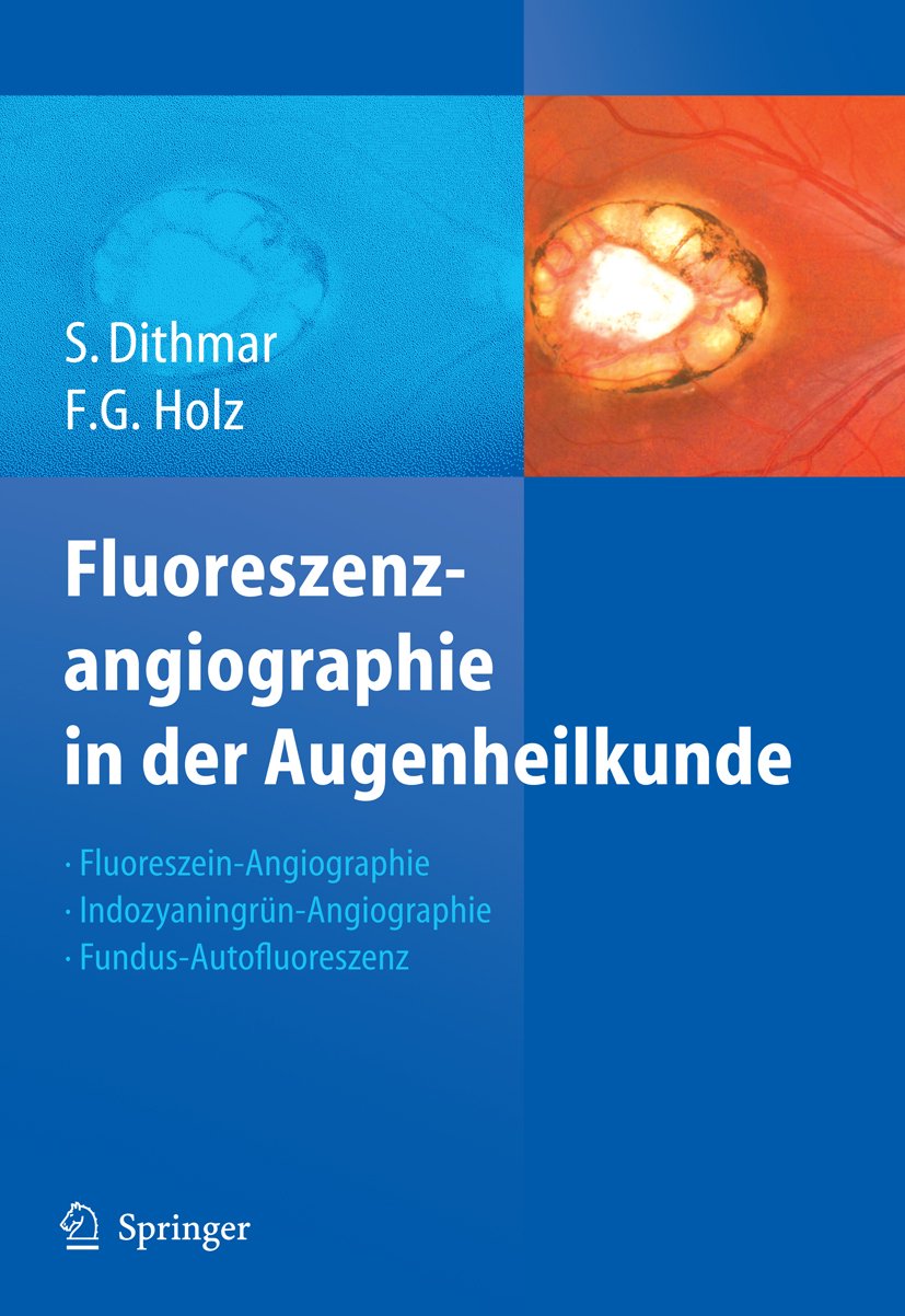 Fluoreszenzangiographie in der Augenheilkunde: Fluoreszein-Angiographie, Indozyaningrün-Angiographie und Fundus-Autofluoreszenz