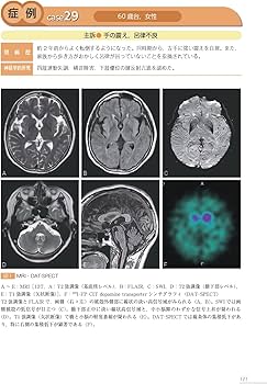 症例で学ぶ中枢神経の画像診断[Web動画付] | 安陪 等思, 平井 俊範