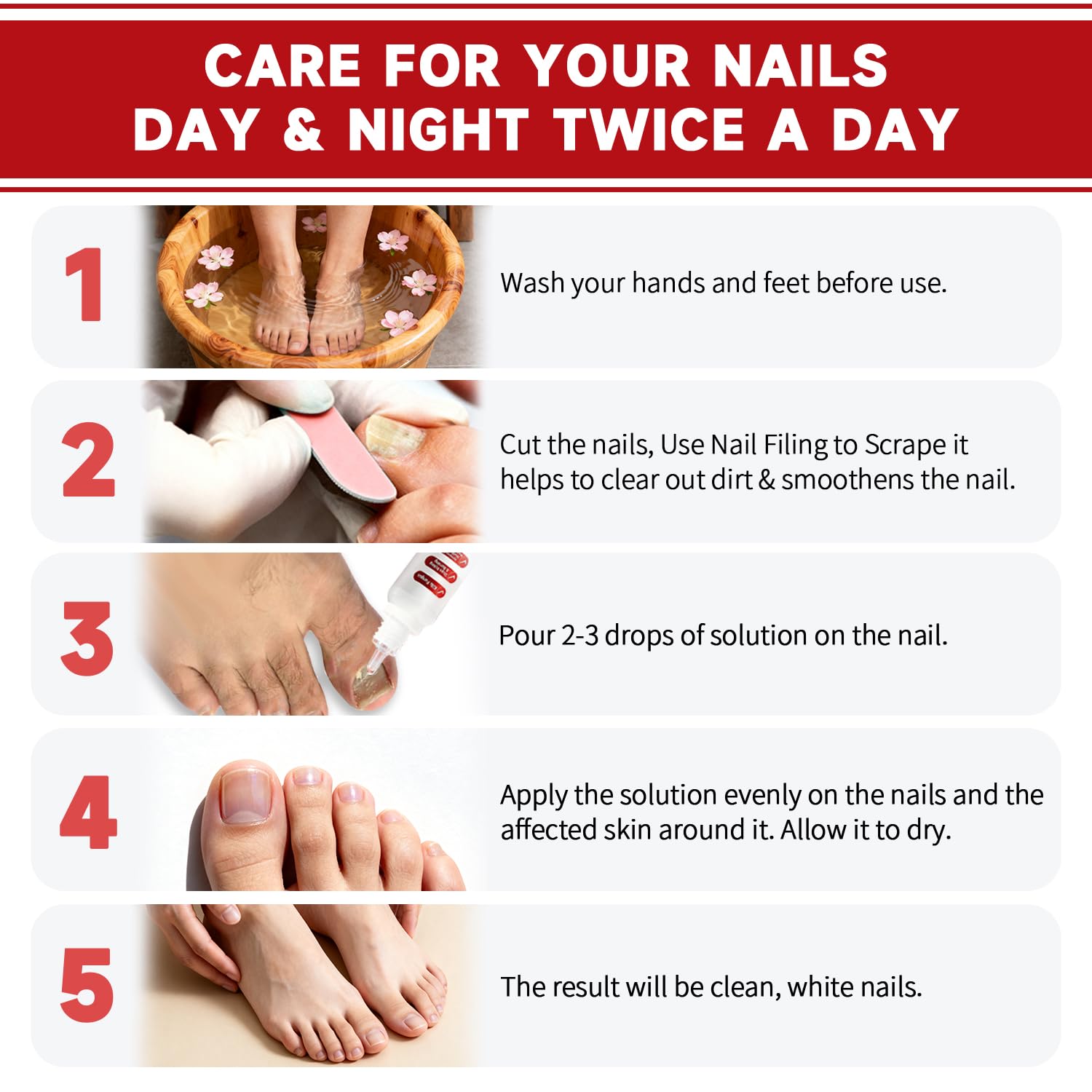 Fungi Nail ToenailTreatment,Gentle Formula,Effectively lmproves Nails for a More Beautiful Appearance（1PCS）