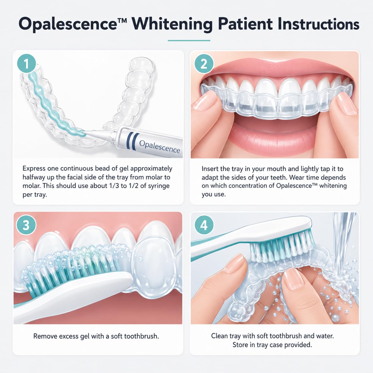Opalescence 10% Teeth Whitening Gel - Refill -5