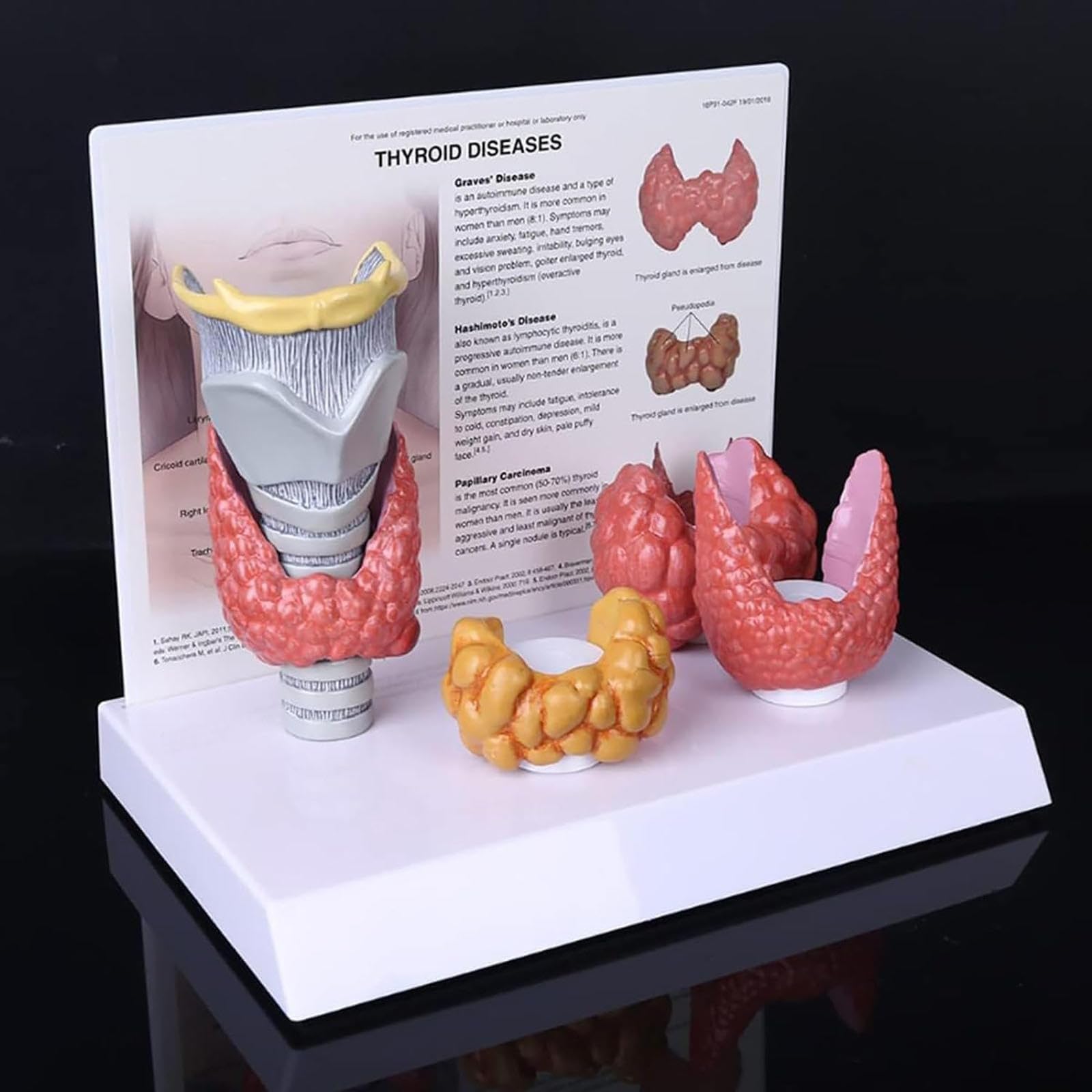 Modèle de thyroïde humaine AMITD pour affichage d'étude en classe