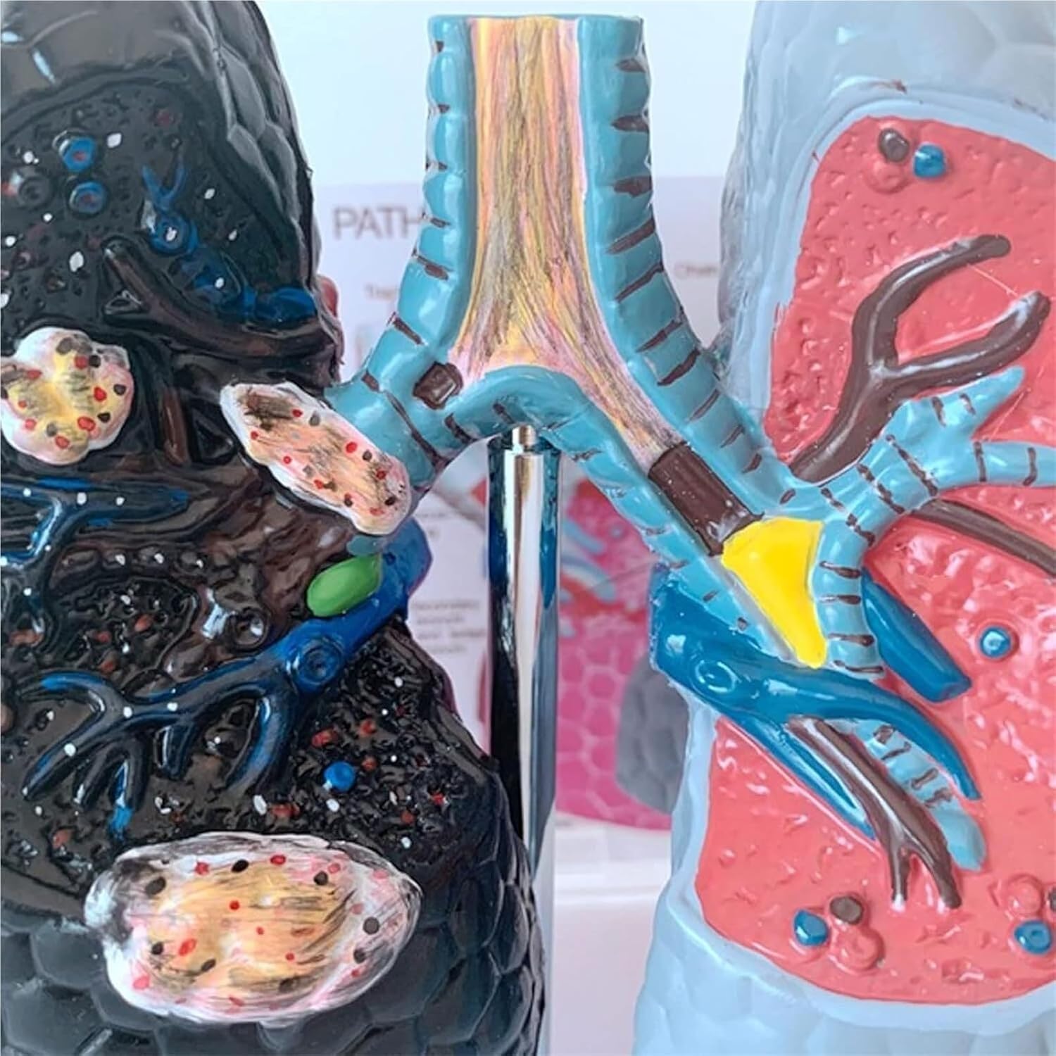 Human Health and Smoking Lung Comparison Model， Healthy vs Smoking Bronchopulmonary Anatomy with English Back Card, for Medical Teaching & Health Education Display