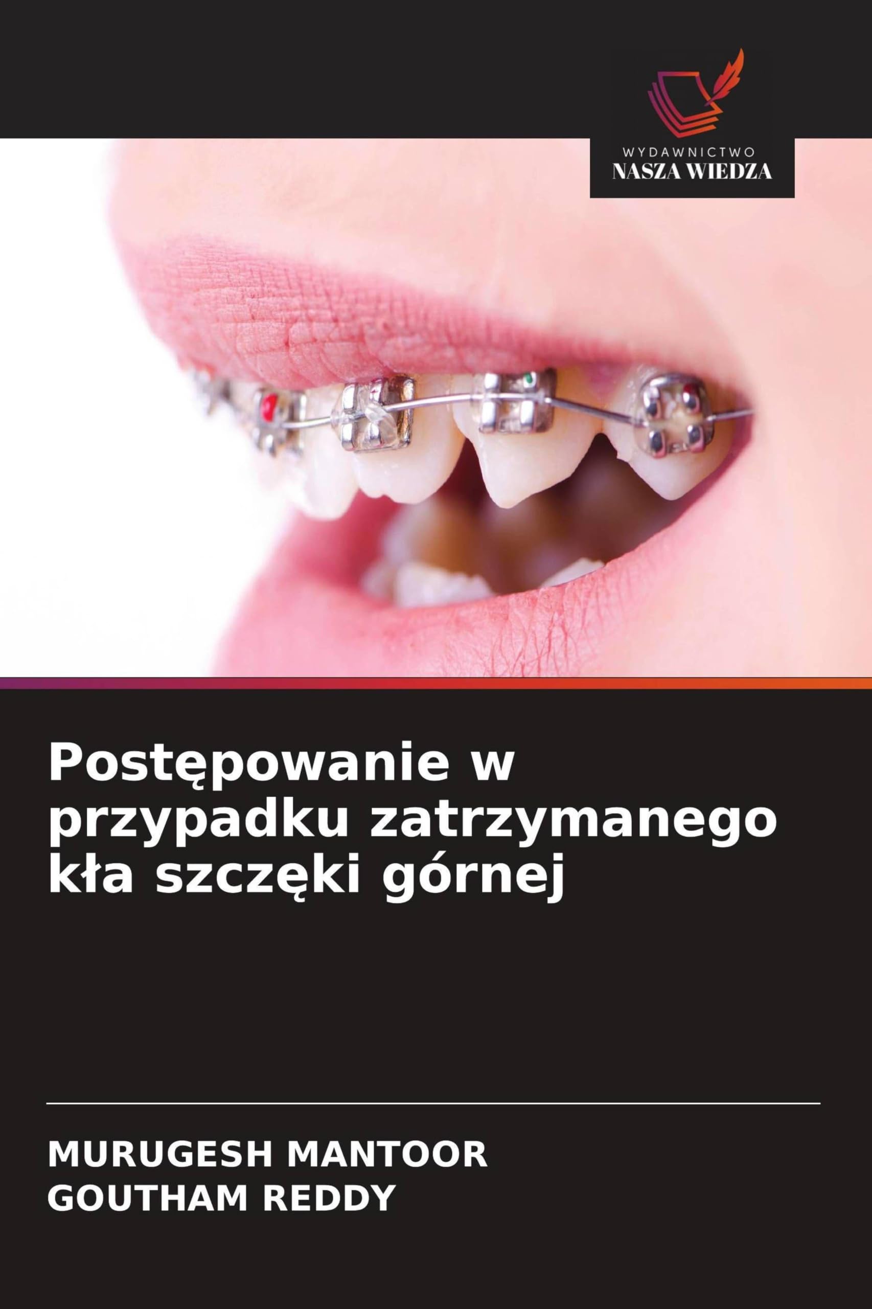Post¿powanie w przypadku zatrzymanego k¿a szcz¿ki górnej
