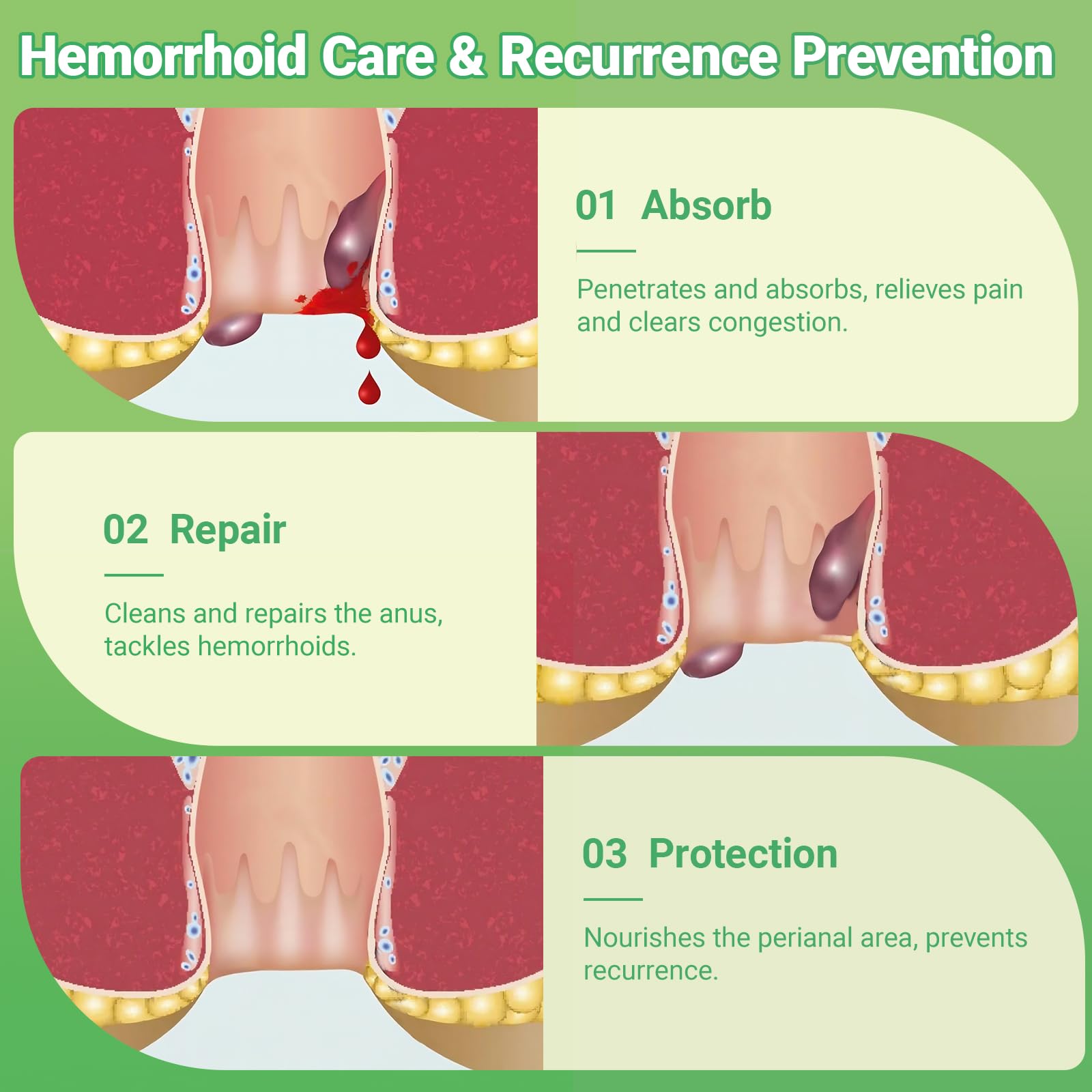 Hemorrhoid Treatment Ointment 10g — Amazon image 4
