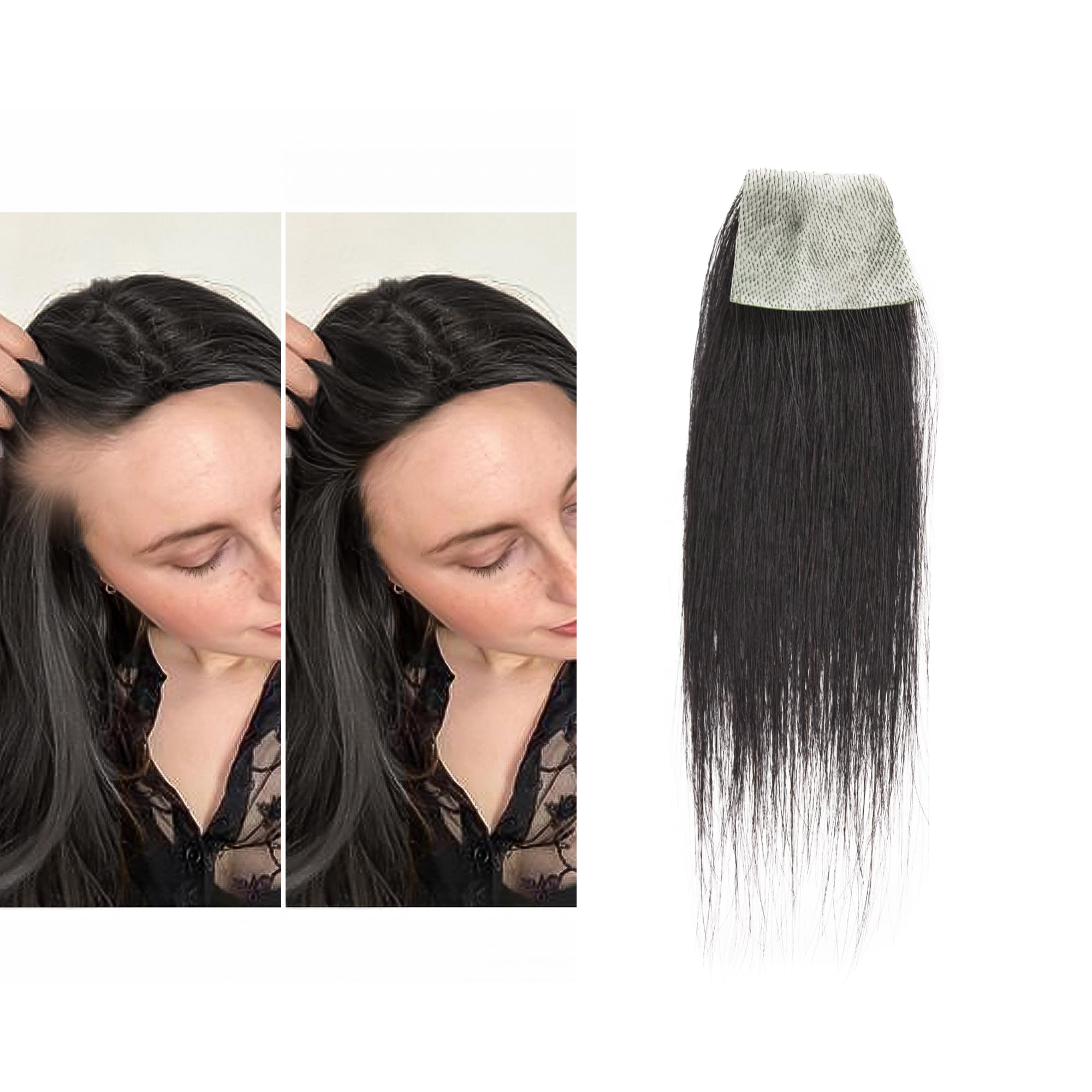 Human Hair Bald Spot Hair Patch Toupee Scar Human Hair