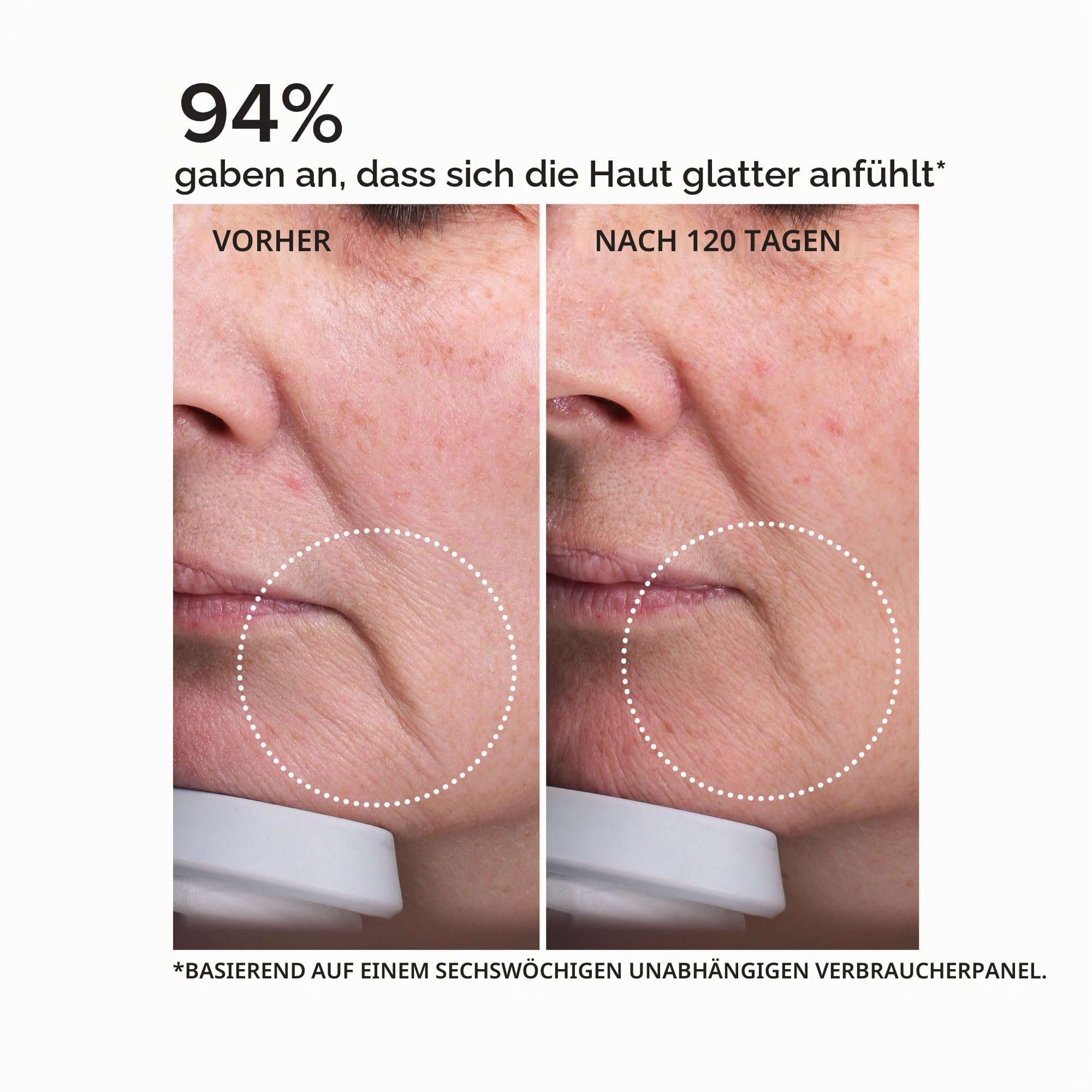 DRMTLGY Nadelloses Serum - Feuchtigkeitsspendendes Gesichtsserum mit Hyaluronsäure, Peptiden & Ceramiden - 30ml