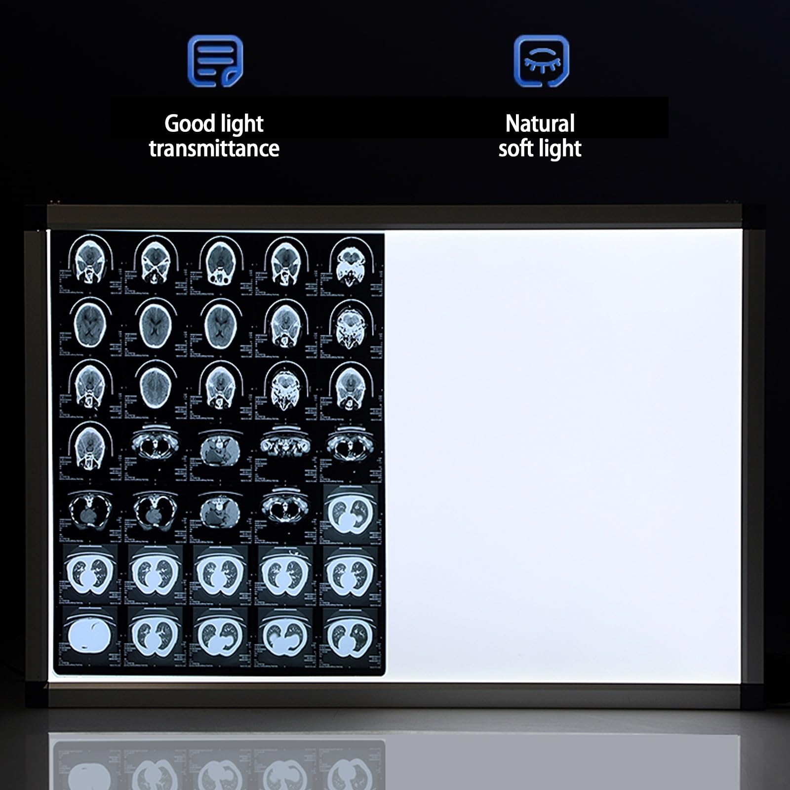 Negativoscopio a LED Scatola di visualizzazione medica a luminosità regolabile 77x47cm per pellicole radiografiche