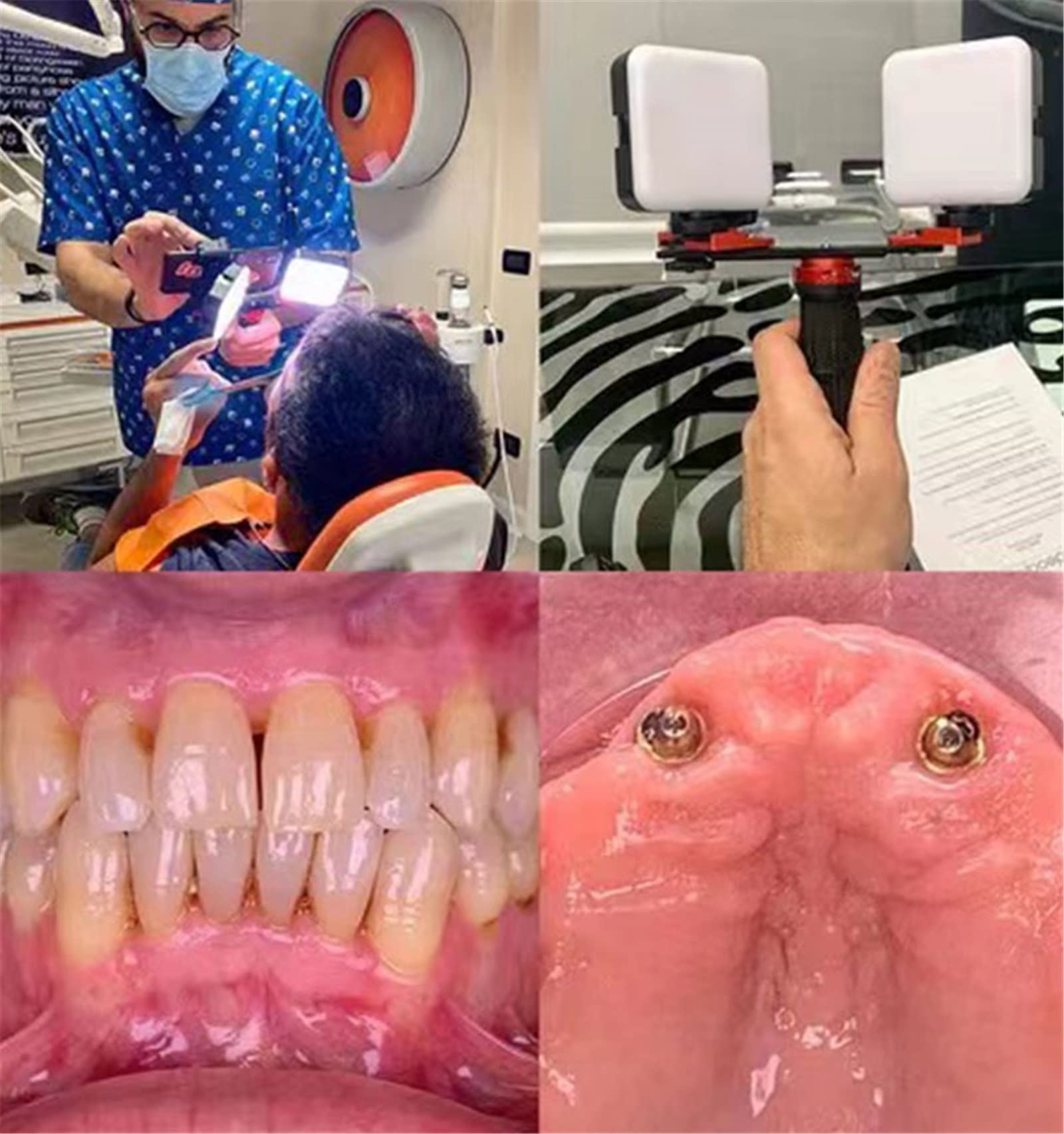 DIRIGIÓ Luz de Flash de fotografía Dental, fotografía móvil DIRIGIÓ Ligero de la Foto del teléfono Ligera de la Linterna, Equipo de fotografía Dental
