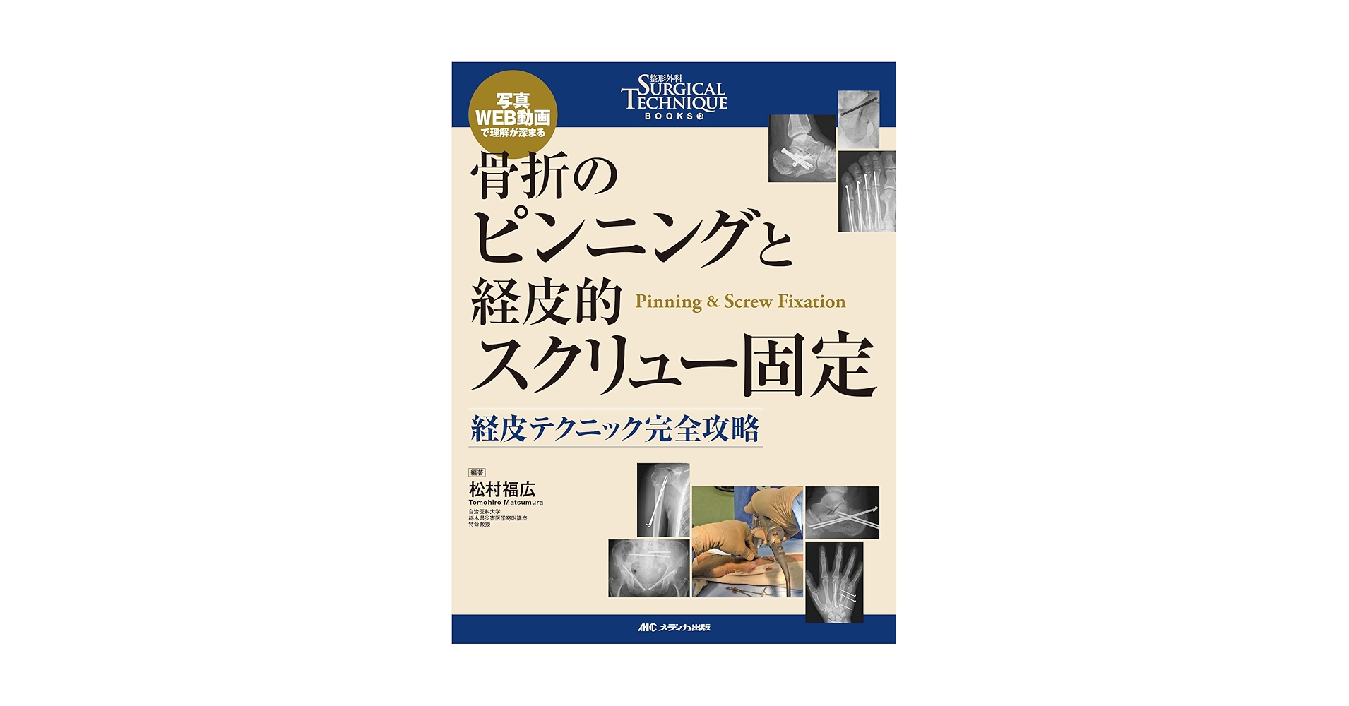 骨折のピンニングと経皮的スクリュー固定 : 経皮テクニック完全攻略　裁断済み 骨折のピンニングと経皮的スクリュー固定： 経皮テクニック完全