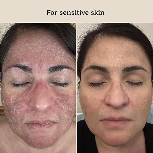 Miniatura 4 de Roe Wellness Baby Cream & Baby Serum Power Pair Biome Barrier  Para todas las pieles y edades  Cuerpo hidratante, cara, piel seca irritada para