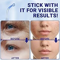 Vista 3 de UUPAS - Accesorio de vidrio de repuesto para tubo doblado