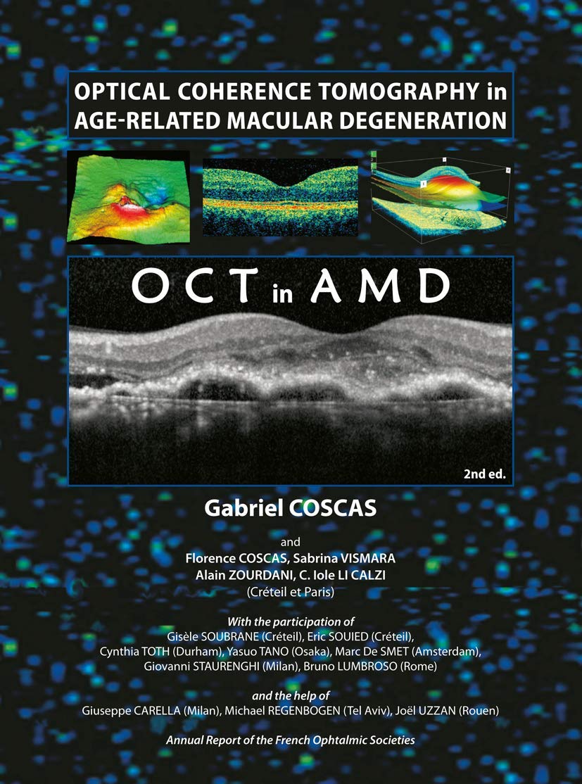 Optical Coherence Tomography in Age-Related Macular Degeneration (OCT in AMD)