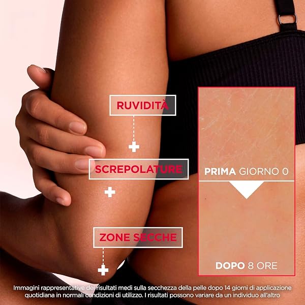 Mixa Crema Corpo Rigenerante, Per Pelle Secca e Ruvida, Pelle Idratata e Lenita per 48H, Barriera Cutanea Riparata e Protetta, Con il 10% di Urea e Niacinamide, Urea Cica Repair +, 400 ml - 3