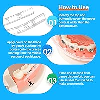 Vista 4 de AIM Protector de labios transparente para aparatos ortopédicos con funda de transporte, fundas cómodas, alternativa a la cera, protector de dientes