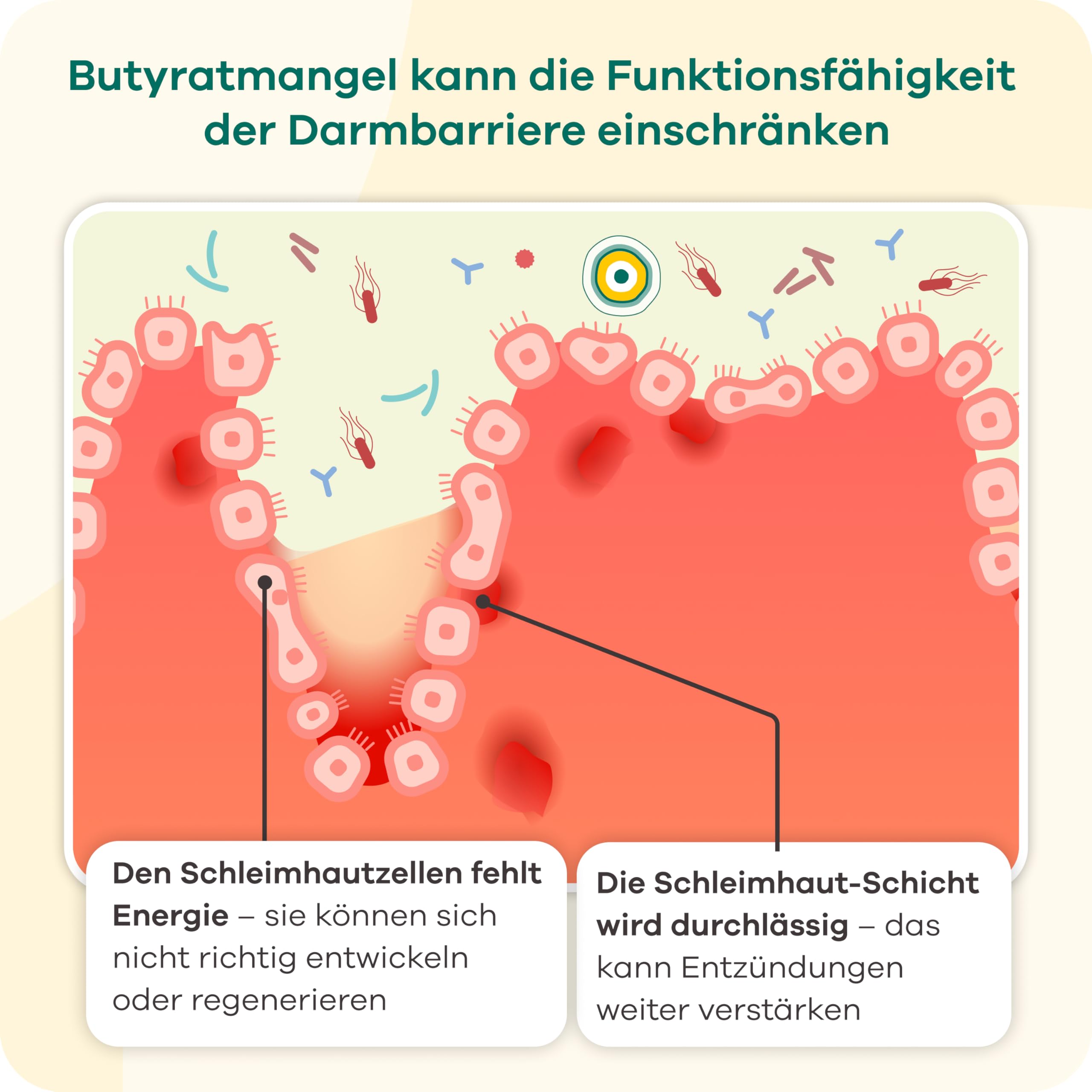 Butyzol Mikroverkapseltes Natriumbutyrat 60 Kapseln – Bei Reizdarmsyndrom, Divertikelkrankheit, Morbus Crohn, Colitis ulcerosa – Patentiert & Wirksamkeit durch Studien belegt