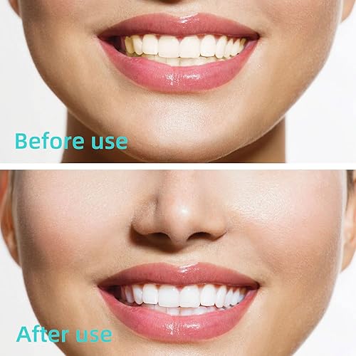 Miniatura 9 de GOUWEIBA 100 piezas de cepillo interdental desechable, palillo de dientes, cabezal de hilo dental dental, higiene dental oral, hilo dental, higiene