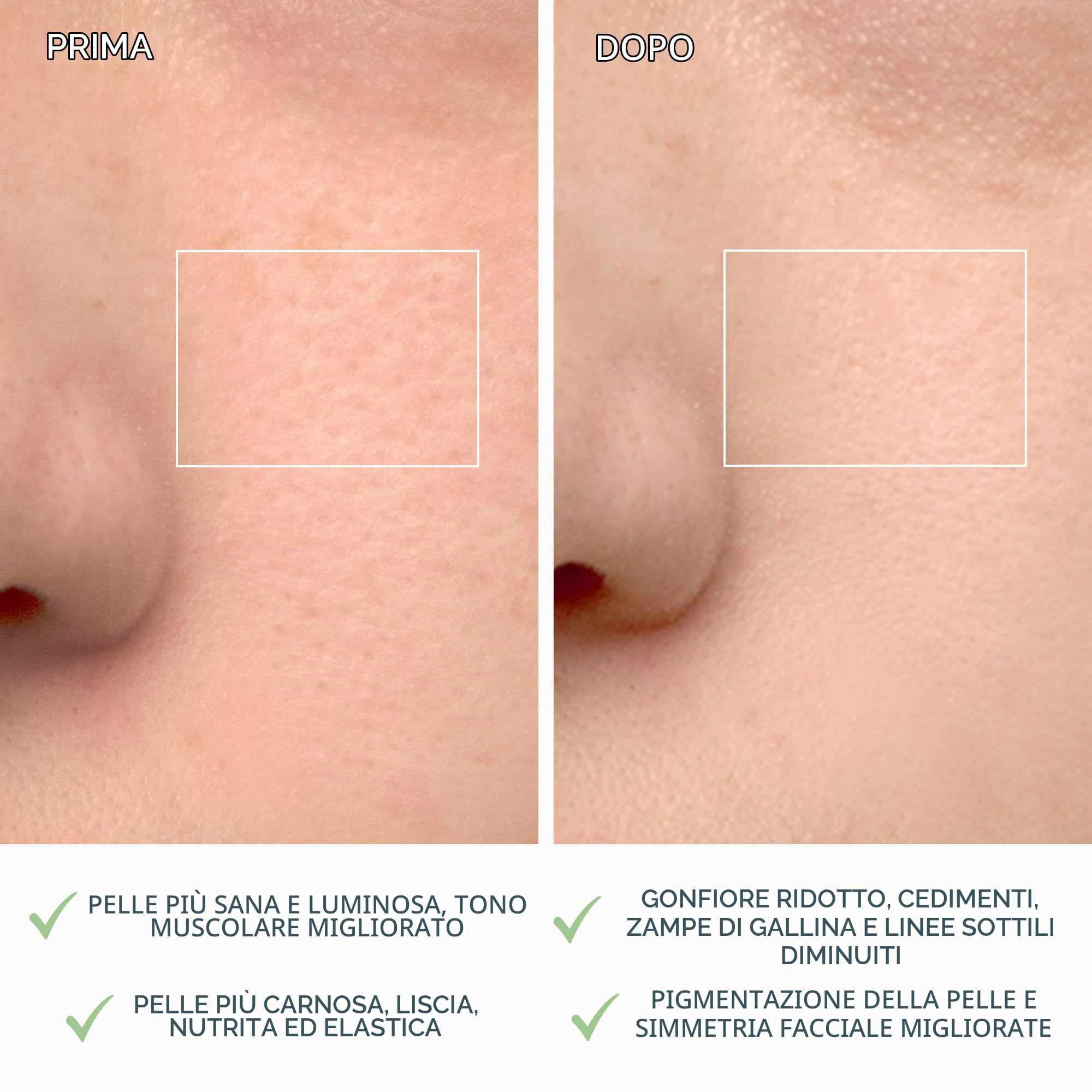 FOREO LUNA 4, spazzola detergente viso - Massaggio viso rassodante - Spazzola viso anti-age - Favorisce l'assorbimento delle formule di skincare - Pulizia viso semplice - Combination Skin | Spazzola Viso, Massaggiatore, Spazzola In Silicone, Esfoliante Vi