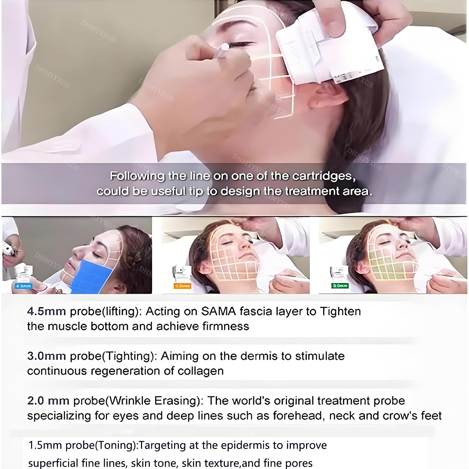 Apparecchio 7 in 1 per rassodare la Pelle Corpo,Apparecchio Lifting Viso, con 7D-Hifu ad Alta intensità,Energia Regolabile per Viso 0,1-2,5J e Corpo 0,1-3,0J,con 2 manipoli Hifu High + 7 sonde