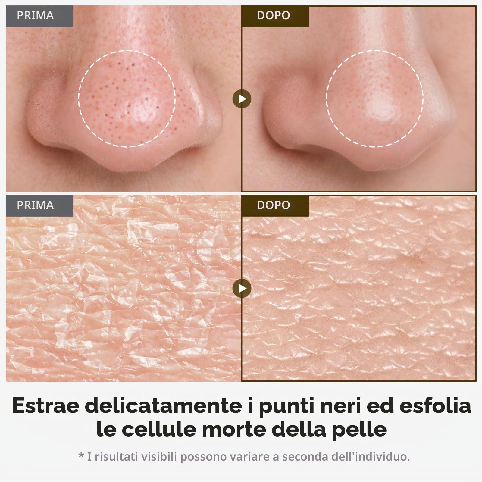 TOSOWOONG Fiala Peeling Riso Bianco 75% per Pelle Spenta e Discromie | Acido Kojico, Niacinamide, Esfoliante, cellule morte, Punti Neri, pori puliti, Viso e Corpo, K-Beauty, 85 ml