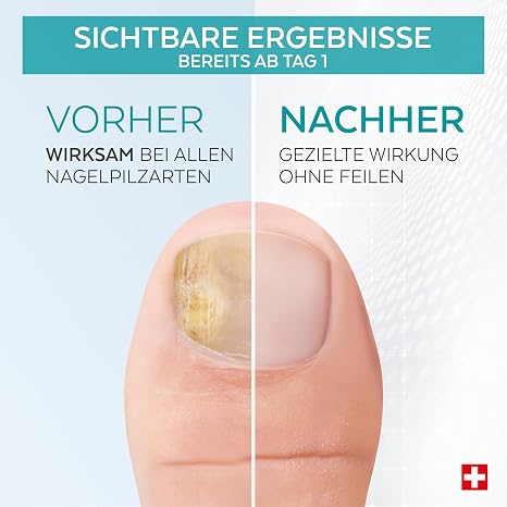 -Plant-based Powerful Antifungal Repairing Purifying and Revitalizing Treatment for Nails Professional Hand/Foot care.Quick & Easy. Made in Switzerland.