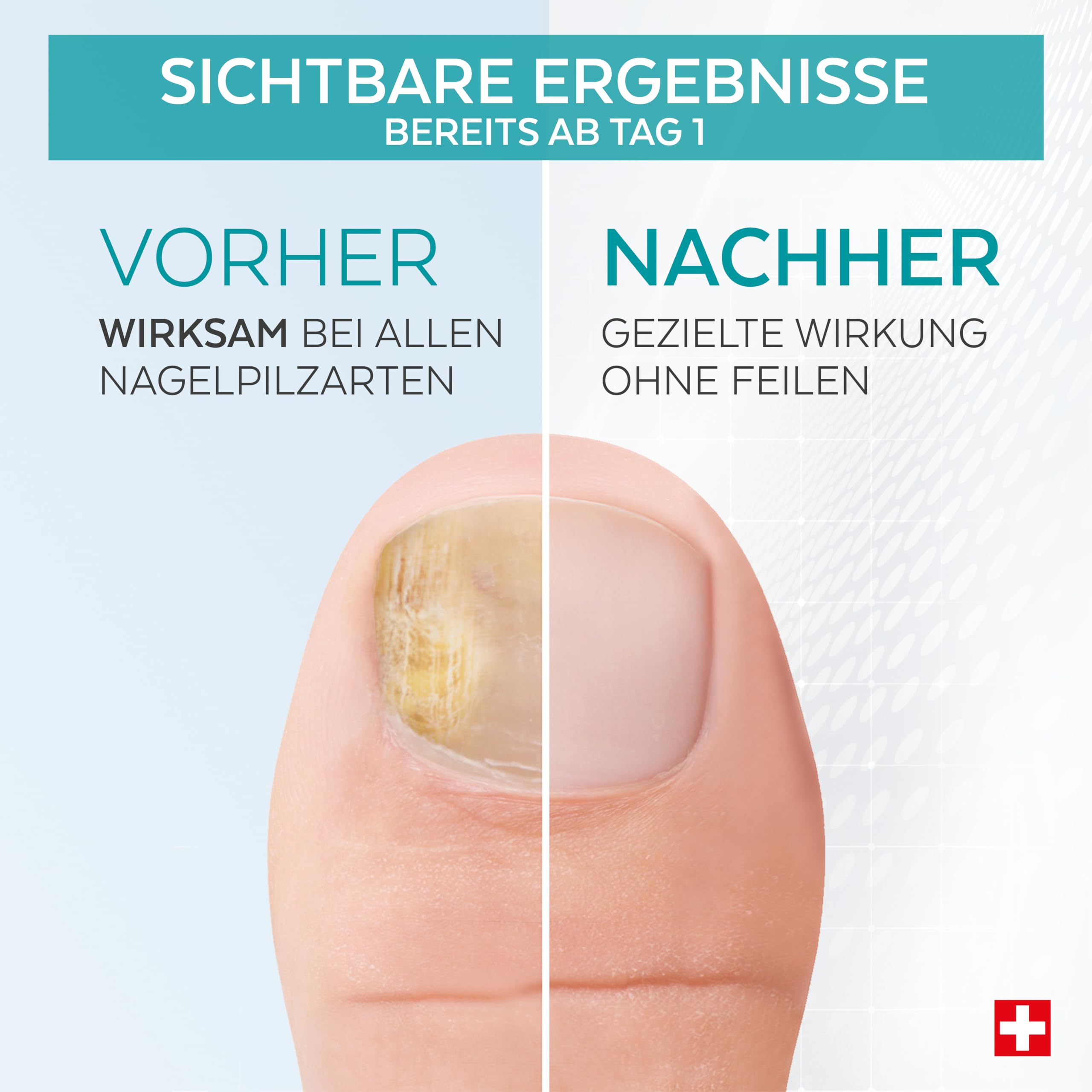 PODERM - NAGELPILZ-BEHANDLUNG | Revitalisierender | Professionelle Fuß/Handpflege | Einfach/Schnell | Made in Switzerland