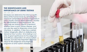 100 x Glucose & Protein Urine Test Strips – 30s Rapid Home Kidney Health Screening Kit – Anti-VC Interference, PET Material, Professional Accuracy for Early Detection