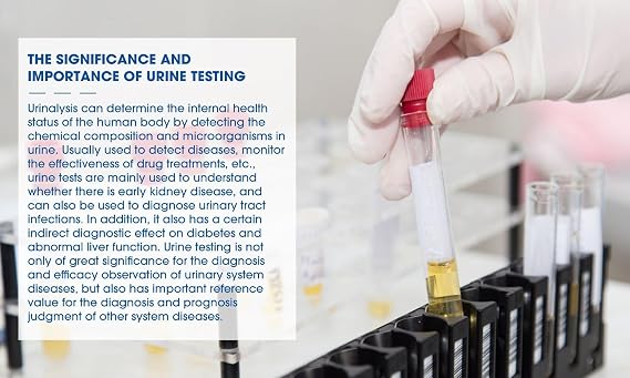 100 x Glucose & Protein Urine Test Strips – 30s Rapid Home Kidney Health Screening Kit – Anti-VC Interference, PET Material, Professional Accuracy for Early Detection
