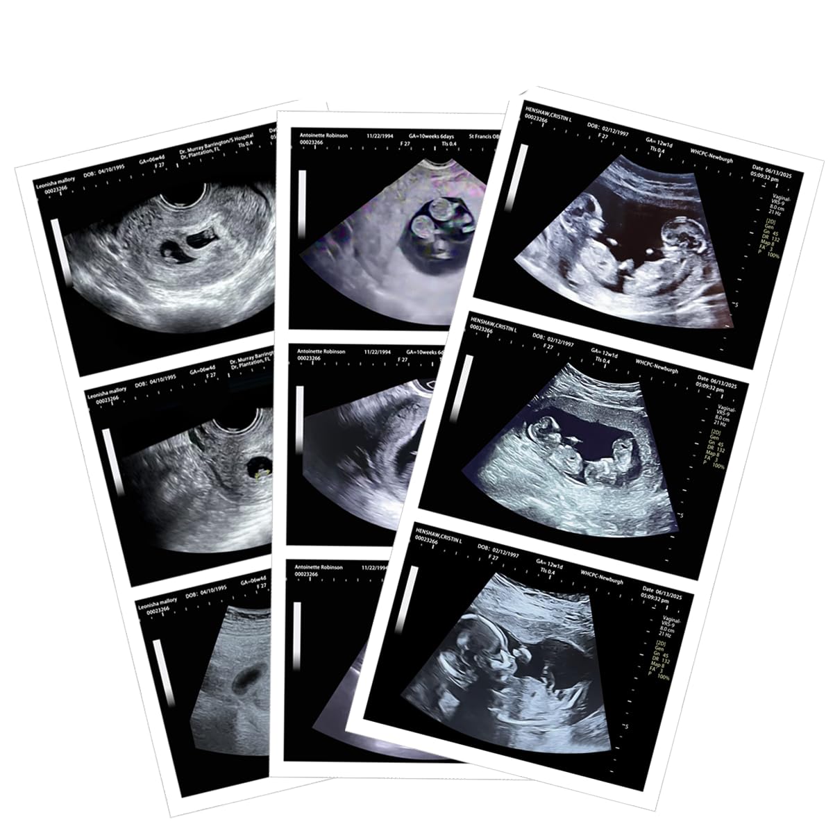 Generic Personalizable Fake Ultrasound Image – Funny Gift & Novelty Item for Pregnancy Announcement, Baby Shower Decoration, Surprise for Family & Friends