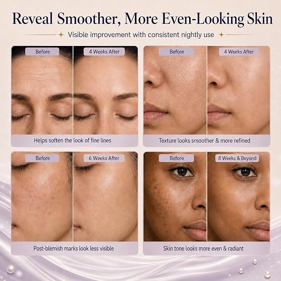 Retinol Skin Booster Serum 0.1% Encapsulated Retinol Serum for Face