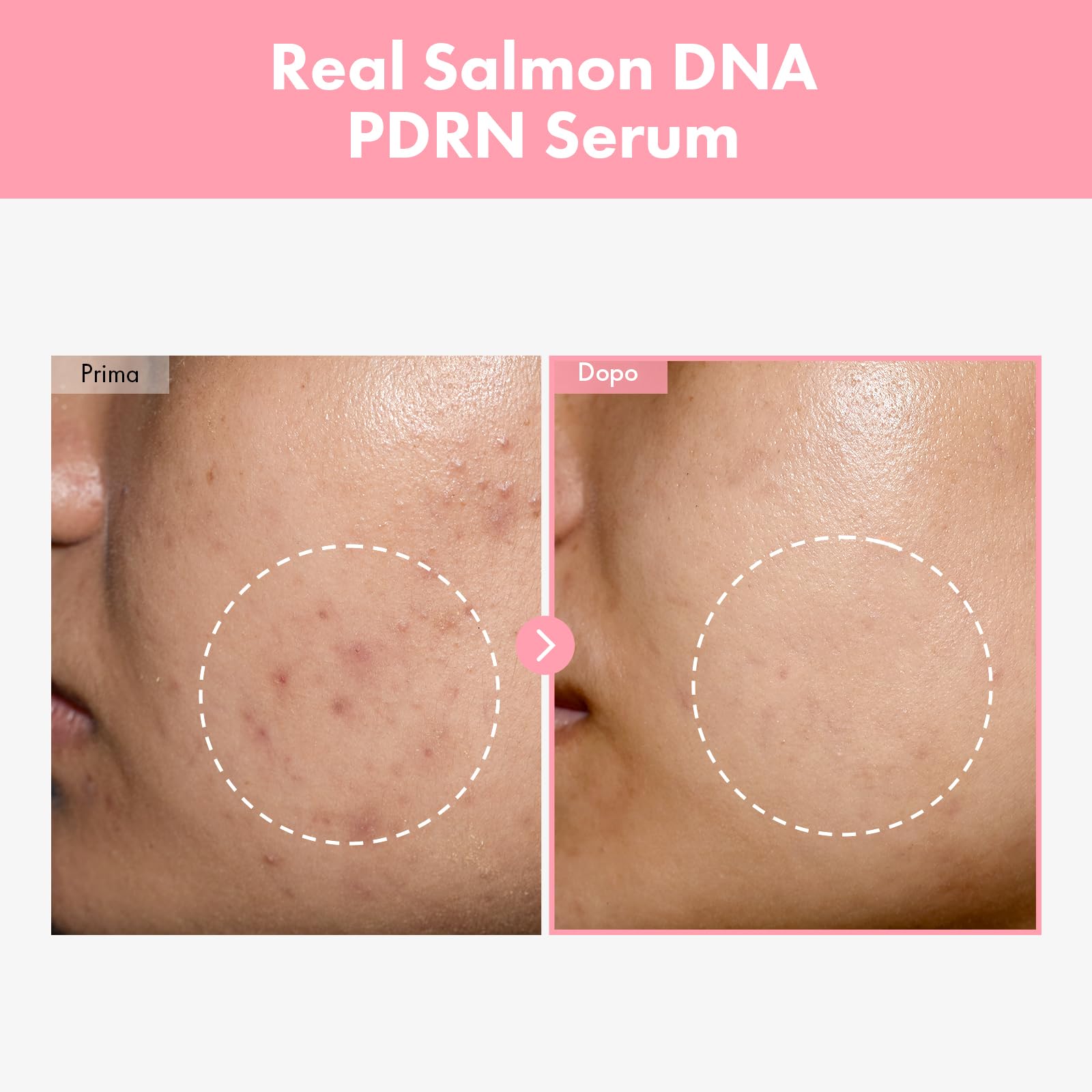 TOSOWOONG Siero Pink Peptide PDRN con 10.320 ppm di DNA di Salmone, 12 Peptidi, Niacinamide, Idratante, Illuminante, Uniformante, Tonificante, Skincare Coreana, 33ml