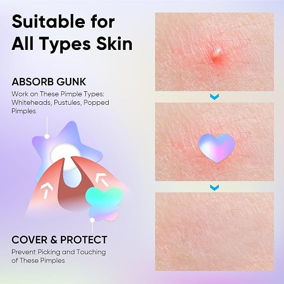 AUSLKA Shining Pimple Patches for Face, Multiple Shape Blemish Stickers with Salicylic Acid and Tea Tree Oil, Face Spot Stickers Zit Patches Absorb Liquid Quickly 300 Pcs