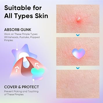 AUSLKA Shining Pimple Patches for Face, Multiple Shape Blemish Stickers with Salicylic Acid and Tea Tree Oil, Face Spot Stickers Zit Patches Absorb Liquid Quickly 300 Pcs