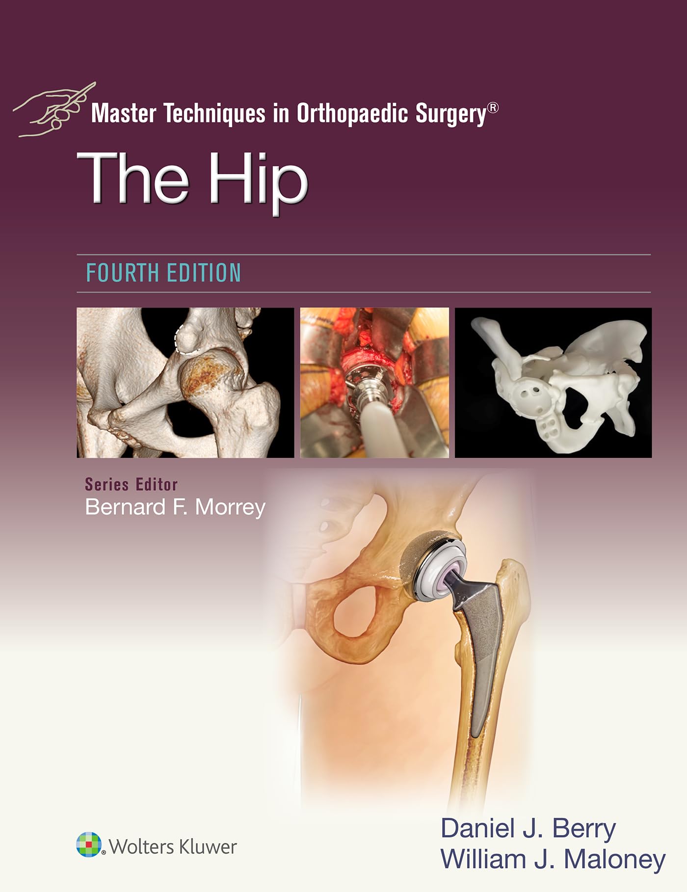 Master Techniques in Orthopaedic Surgery: The Hip: eBook without Multimedia (English Edition)