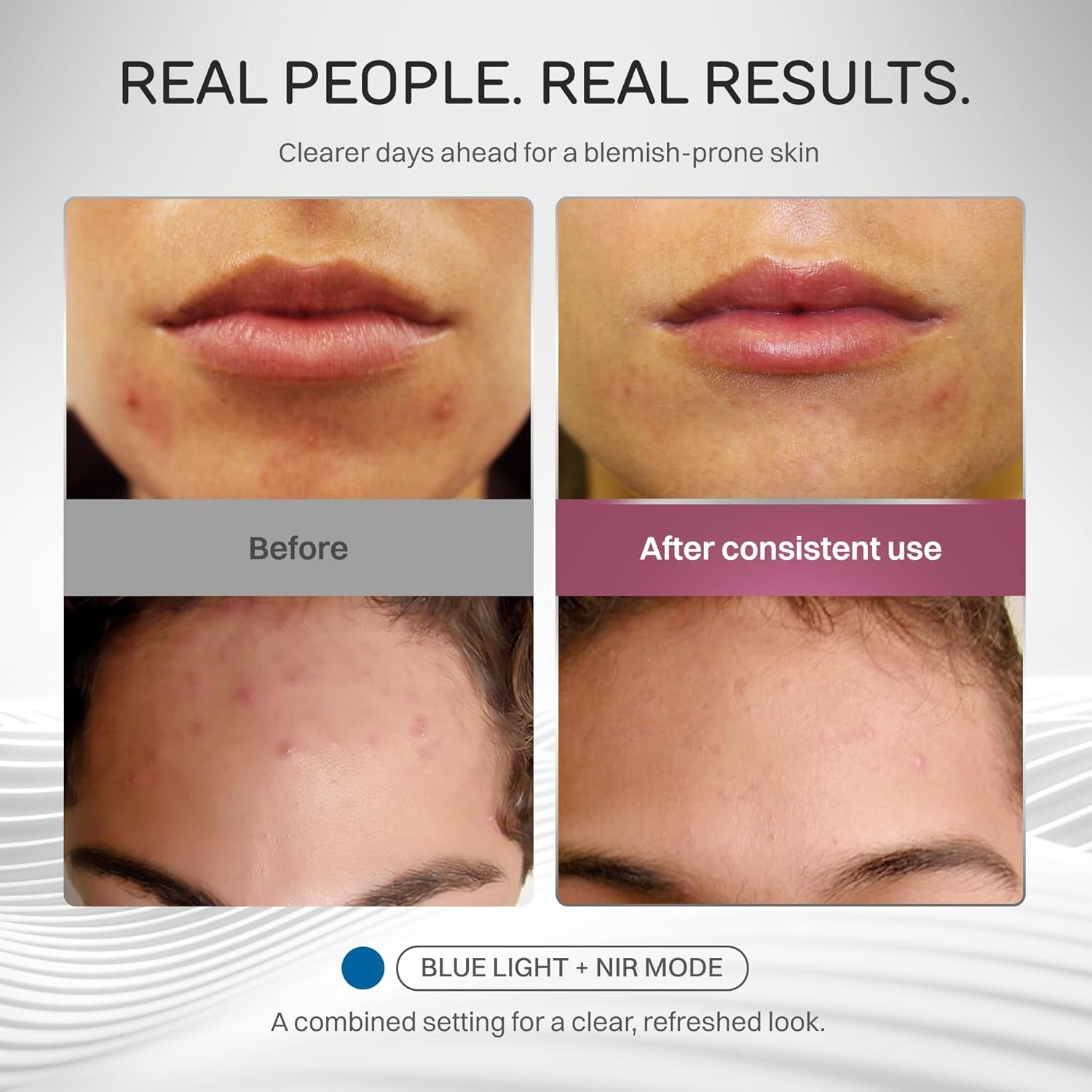 Numiere Time Keeper LED Face Mask – Lightweight, Flexible, and Multi-Wavelength Red, Blue, & Infrared (NIR) LED Contour Technology Wearable Facial Beauty Device for Personal Use and Skincare Routines